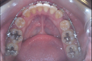 歯フェチの泉～口腔銀幕への誘い～